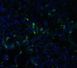 Invitrogen ACE2 Polyclonal Antibody 100 &mu;g; Unconjugated:Antibodies,