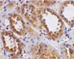Invitrogen ACE2 Polyclonal Antibody 100 &mu;g; Unconjugated:Antibodies,