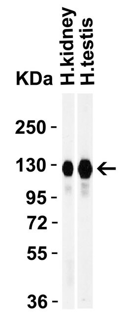 Invitrogen ACE2 Polyclonal Antibody 100 &mu;g; Unconjugated:Antibodies,