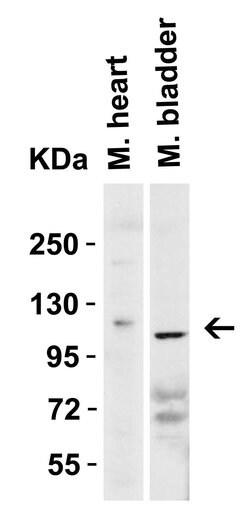 Invitrogen ACE2 Polyclonal Antibody 100 &mu;g; Unconjugated:Antibodies,
