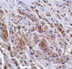 Invitrogen TRIM5 gamma Polyclonal Antibody 100 &mu;g | Buy Online | Invitrogen&trade; | Fisher Scientific