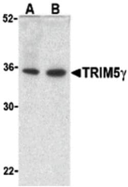 Invitrogen TRIM5 gamma Polyclonal Antibody 100 &mu;g | Buy Online | Invitrogen&trade; | Fisher Scientific