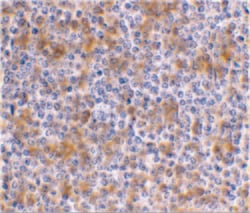 Invitrogen APOBEC3G Polyclonal Antibody 100 &mu;g | Buy Online | Invitrogen&trade; | Fisher Scientific