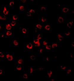 Invitrogen TLR11 Polyclonal Antibody 100 &mu;g; Unconjugated:Antibodies