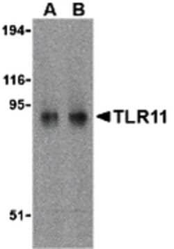 Invitrogen TLR11 Polyclonal Antibody 100 &mu;g; Unconjugated:Antibodies