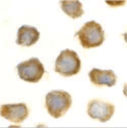 Invitrogen TLR11 Polyclonal Antibody 100 &mu;g | Buy Online | Invitrogen&trade; | Fisher Scientific