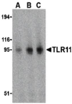 Invitrogen TLR11 Polyclonal Antibody 100 &mu;g | Buy Online | Invitrogen&trade; | Fisher Scientific