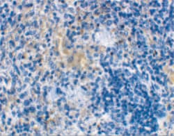 Invitrogen MD-2 Polyclonal Antibody 100 &mu;g | Buy Online | Invitrogen&trade; | Fisher Scientific