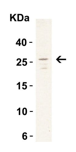 Invitrogen MD-2 Polyclonal Antibody 100 &mu;g | Buy Online | Invitrogen&trade; | Fisher Scientific