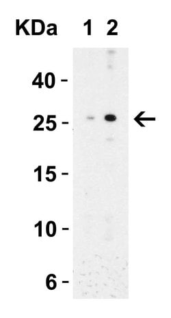 Invitrogen MD-2 Polyclonal Antibody 100 &mu;g | Buy Online | Invitrogen&trade; | Fisher Scientific