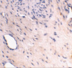 Invitrogen ARMER Polyclonal Antibody 100 &mu;g; Unconjugated:Antibodies,