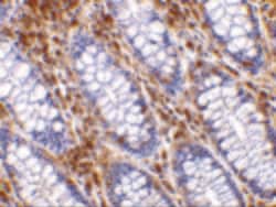 Invitrogen HTRA2 Polyclonal Antibody 100 &mu;g | Buy Online | Invitrogen&trade; | Fisher Scientific