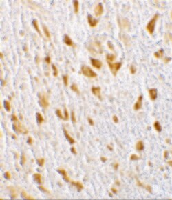 Invitrogen CENTG1 Polyclonal Antibody 100 &mu;g | Buy Online | Invitrogen&trade; | Fisher Scientific