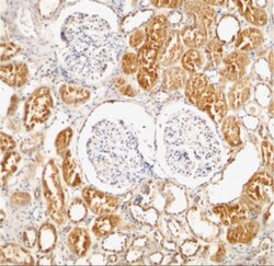 Invitrogen XIAP Polyclonal Antibody 100 &mu;g | Buy Online | Invitrogen&trade; | Fisher Scientific