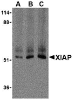 Invitrogen XIAP Polyclonal Antibody 100 &mu;g | Buy Online | Invitrogen&trade; | Fisher Scientific