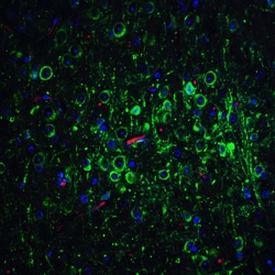 Invitrogen Bcl-2 Polyclonal Antibody 100 &mu;g; Unconjugated:Antibodies,
