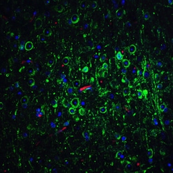 Bcl-2 Polyclonal Antibody, Invitrogen&trade; 100 &mu;g; Unconjugated 