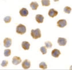Invitrogen Bcl-2 Polyclonal Antibody 100 &mu;g; Unconjugated:Antibodies,