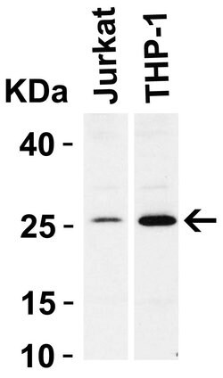 Invitrogen Bcl-2 Polyclonal Antibody 100 &mu;g; Unconjugated:Antibodies,