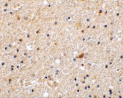 Invitrogen NADE Polyclonal Antibody 100 &mu;g; Unconjugated:Antibodies,