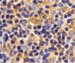 Invitrogen UBC13 Polyclonal Antibody 100 &mu;g; Unconjugated:Antibodies,