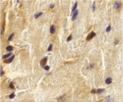 ECSIT Polyclonal Antibody 100 &mu;g | Buy Online | Invitrogen | Fisher Scientific