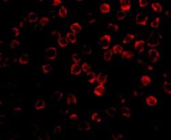 TAB1 Polyclonal Antibody 100 &mu;g | Buy Online | Invitrogen | Fisher Scientific