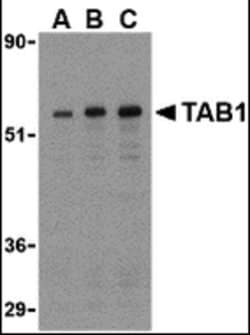 TAB1 Polyclonal Antibody 100 &mu;g | Buy Online | Invitrogen | Fisher Scientific