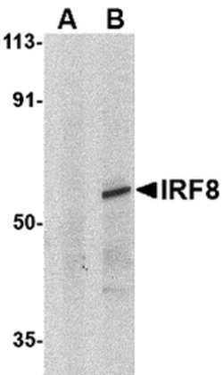 Invitrogen IRF8 Polyclonal Antibody 100 μg; Unconjugated:Antibodies,