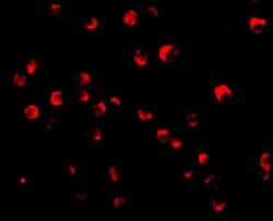 Caspase 8 Polyclonal Antibody:Antibodies, Polyclonal