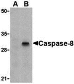 Caspase 8 Polyclonal Antibody:Antibodies, Polyclonal