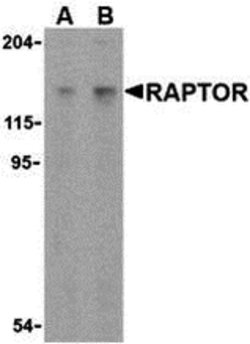 Invitrogen Raptor Polyclonal Antibody 100 &mu;g | Buy Online | Invitrogen&trade; | Fisher Scientific