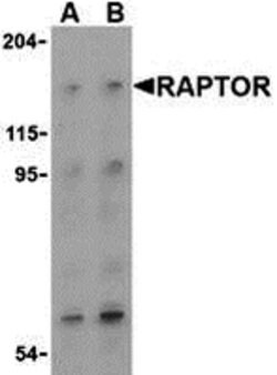 Invitrogen Raptor Polyclonal Antibody 100 μg; Unconjugated:Antibodies,