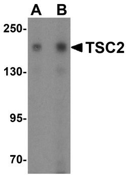Invitrogen TSC2 Polyclonal Antibody 100 &mu;g | Buy Online | Invitrogen&trade; | Fisher Scientific