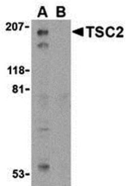 Invitrogen TSC2 Polyclonal Antibody 100 &mu;g | Buy Online | Invitrogen&trade; | Fisher Scientific