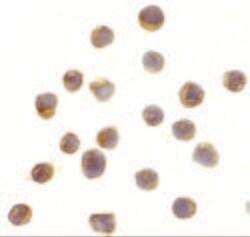 Invitrogen RSK1 Polyclonal Antibody 100 &mu;g; Unconjugated:Antibodies,