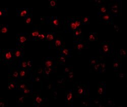 Invitrogen RSK1 Polyclonal Antibody 100 &mu;g; Unconjugated:Antibodies,