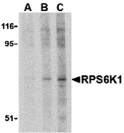 Invitrogen RSK1 Polyclonal Antibody 100 &mu;g; Unconjugated:Antibodies,