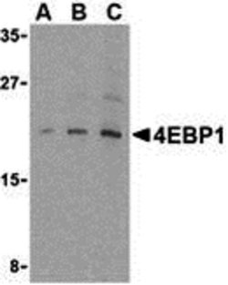 4EBP1 Polyclonal Antibody 100 &mu;g | Buy Online | Invitrogen | Fisher Scientific