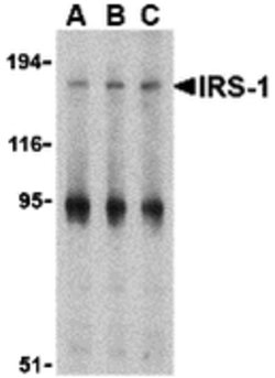 Invitrogen IRS1 Polyclonal Antibody 100 &mu;g | Buy Online | Invitrogen&trade; | Fisher Scientific