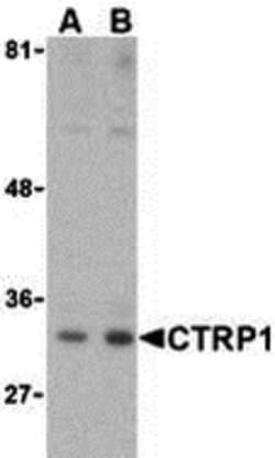 Invitrogen CTRP1 Polyclonal Antibody 100 &mu;g; Unconjugated:Antibodies,