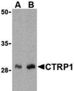 Invitrogen CTRP1 Polyclonal Antibody 100 &mu;g; Unconjugated:Antibodies,