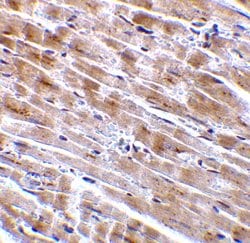 Invitrogen CTRP3 Polyclonal Antibody 100 &mu;g | Buy Online | Invitrogen&trade; | Fisher Scientific