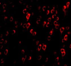 Invitrogen CTRP4 Polyclonal Antibody 100 &mu;g; Unconjugated:Antibodies,