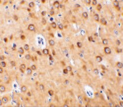 Invitrogen CTRP4 Polyclonal Antibody 100 &mu;g; Unconjugated:Antibodies,