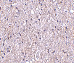 CTRP4 Polyclonal Antibody:Antibodies, Polyclonal