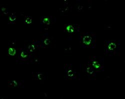 CTRP6 Polyclonal Antibody 100 &mu;g | Buy Online | Invitrogen | Fisher Scientific
