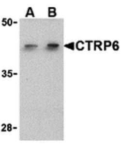 CTRP6 Polyclonal Antibody 100 &mu;g | Buy Online | Invitrogen | Fisher Scientific