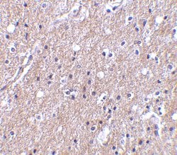 CTRP6 Polyclonal Antibody:Antibodies, Polyclonal