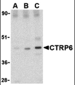 CTRP6 Polyclonal Antibody:Antibodies, Polyclonal